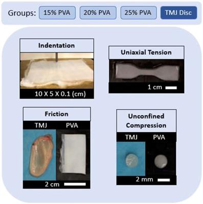 A mechanical evaluation of polyvinyl alcohol hydrogels for temporomandibular joint disc replacement